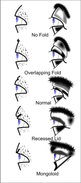 Eye types